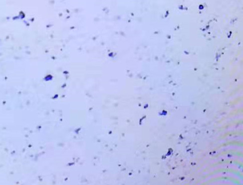 XMD microbial fertilizer