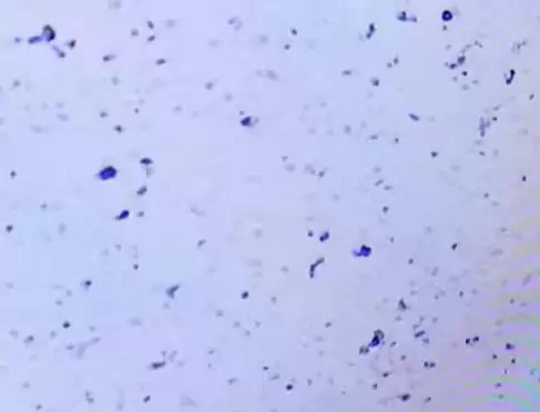 XMD microbial fertilizer